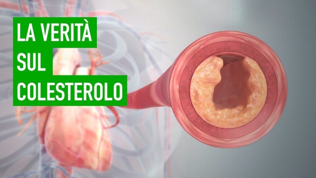 Dieta chetogenica e colesterolo, ecco perché il colesterolo non è il nemico